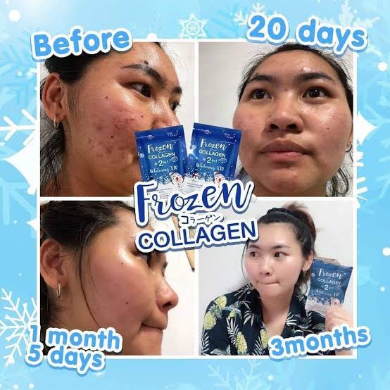 Frozen collagen 2 in 1 whitening x10