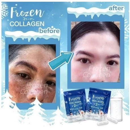 Frozen collagen 2 in 1 whitening x10