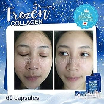Frozen collagen 2 in 1 whitening x10
