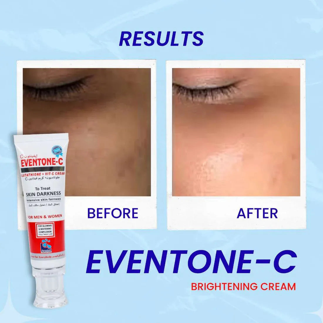 Eventone c buy 1 get 1 free 1880