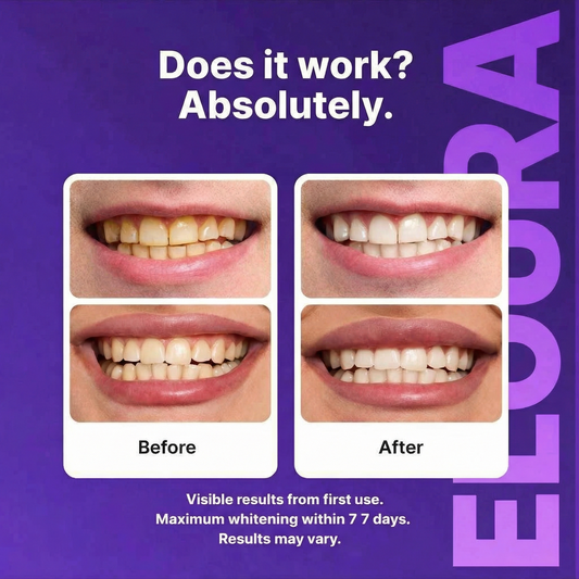Eloura Teeth Whitening Stripes